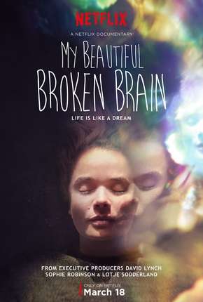 Baixar My Beautiful Broken Brain Torrent